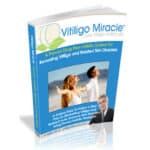Vitiligo-Miracle