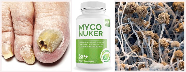 Myco Nuker Review