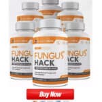 Fungus-Hack-Where-To-Buy