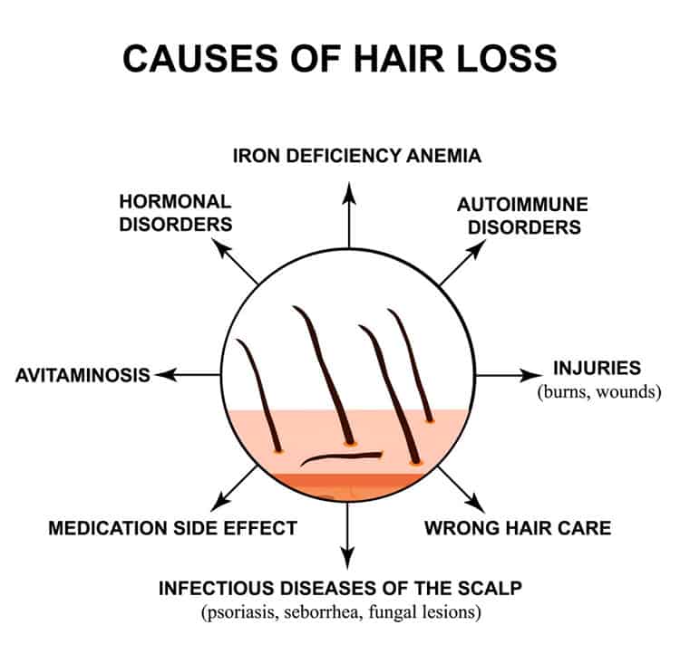 Causes-Of-Hair-Loss