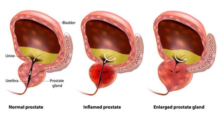 How-Prostate-Work