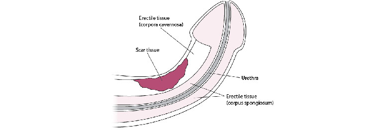 Erectile tissue