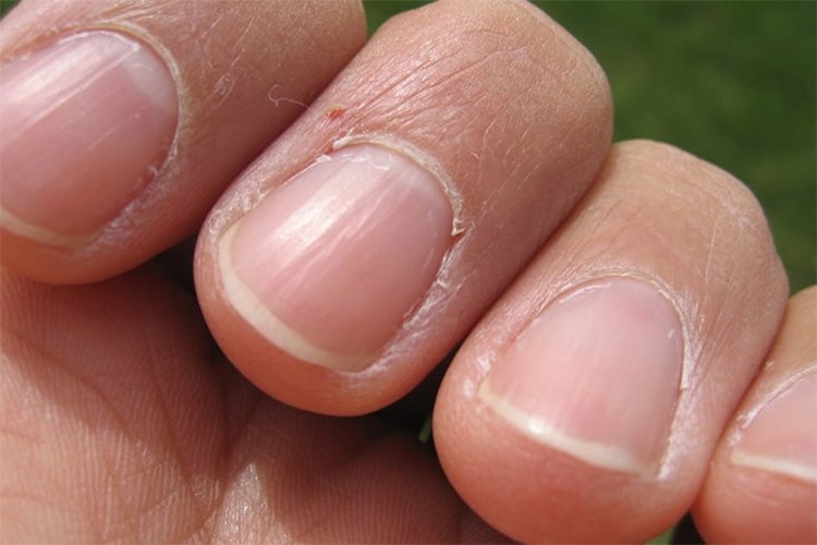 What nails tell you about your health