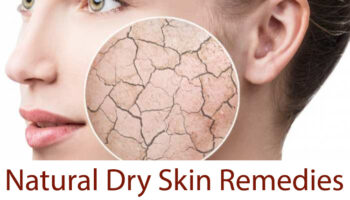 The-Best-Natural-Dry-Skin-Remedies-That-You-Can-Make-At-Home