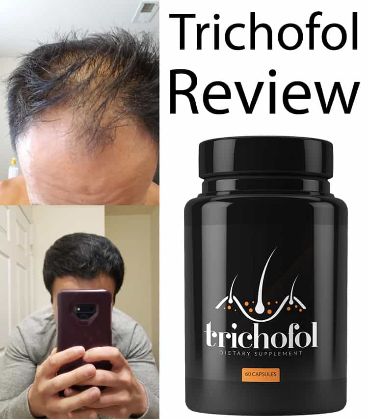 Trichofol Reviews from TheHealthMags