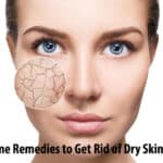 Best 16 Home Remedies to Get Rid of Dry Skin in Summer