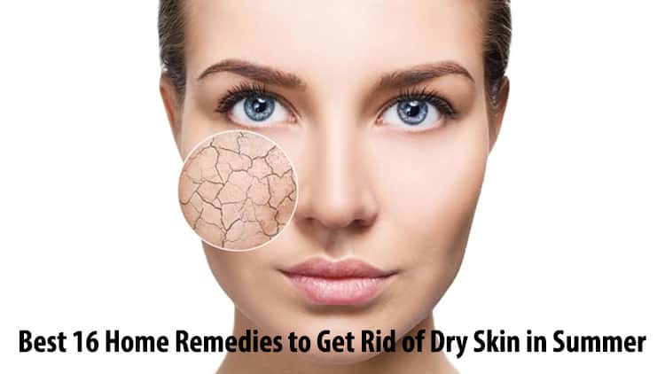 Best 16 Home Remedies to Get Rid of Dry Skin in Summer
