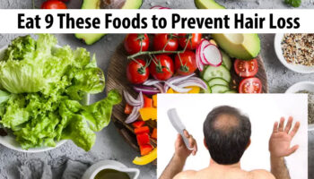 Eat 9 These Foods to Prevent Hair Loss