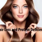 Hair Loss and Protein Deficiency