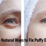Top Natural Ways to Fix Puffy Eyes