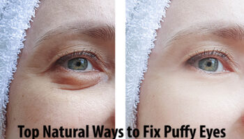 Top Natural Ways to Fix Puffy Eyes