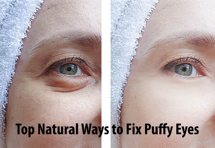 Top Natural Ways to Fix Puffy Eyes