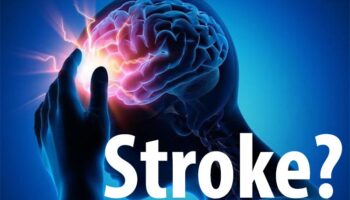 Top Causes of Stroke - All You Need To Know!