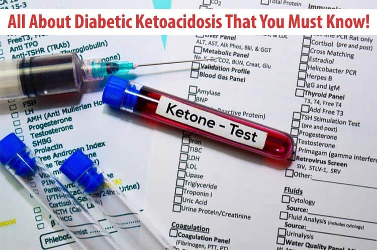 All About Diabetic Ketoacidosis That You Must Know!