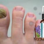 Pronail Complex Review