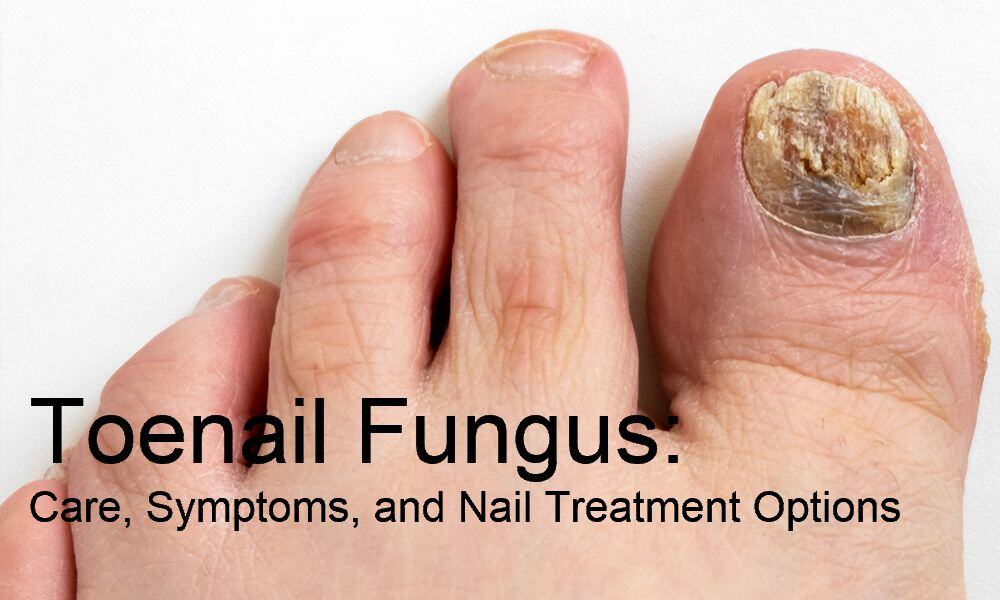 Toenail Fungus: Care, Symptoms, and Nail Treatment Options